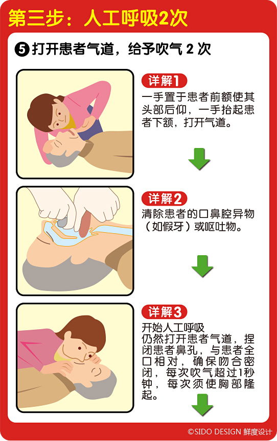 �r���OӋ-���r�ȈD���ķΏ��K��CPR������ָ�ϡ������OӋ